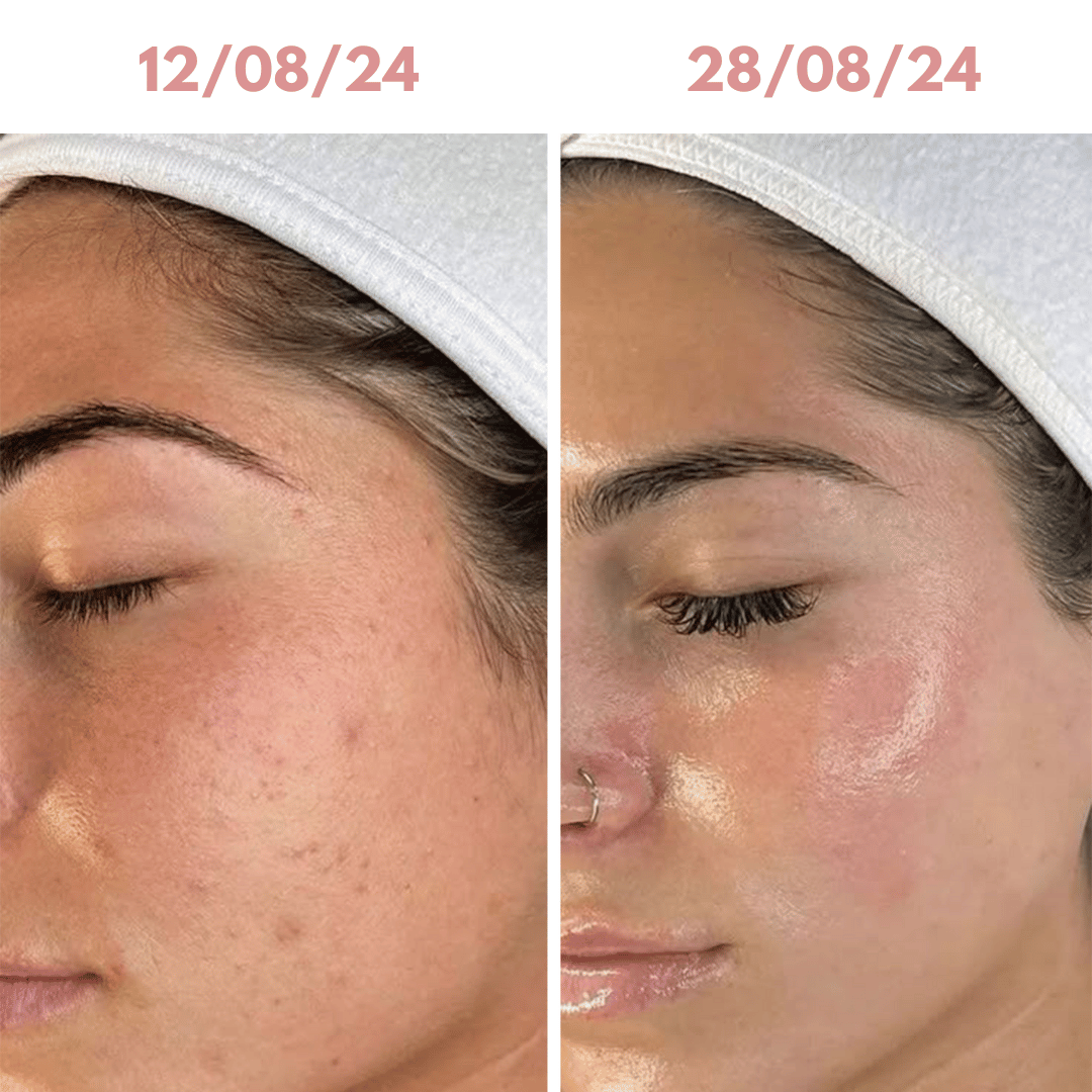 Skinfusion™ Deep Mask