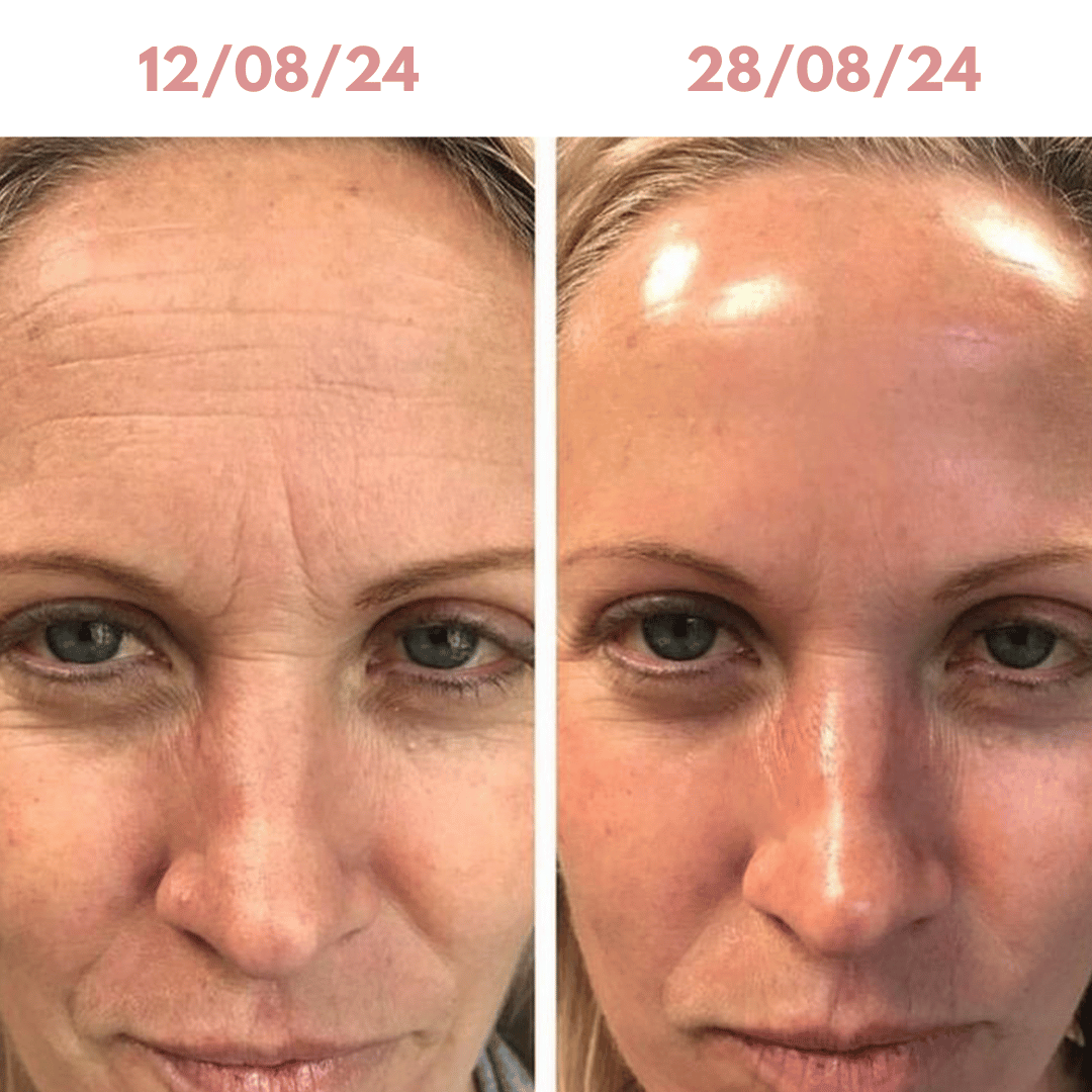 Skinfusion™ Deep Mask
