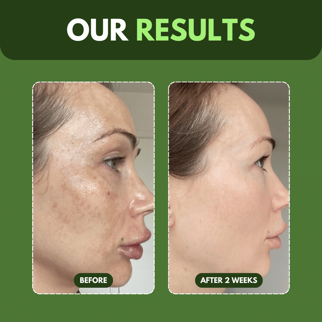 Skinfusion™ Recovery Mud Mask
