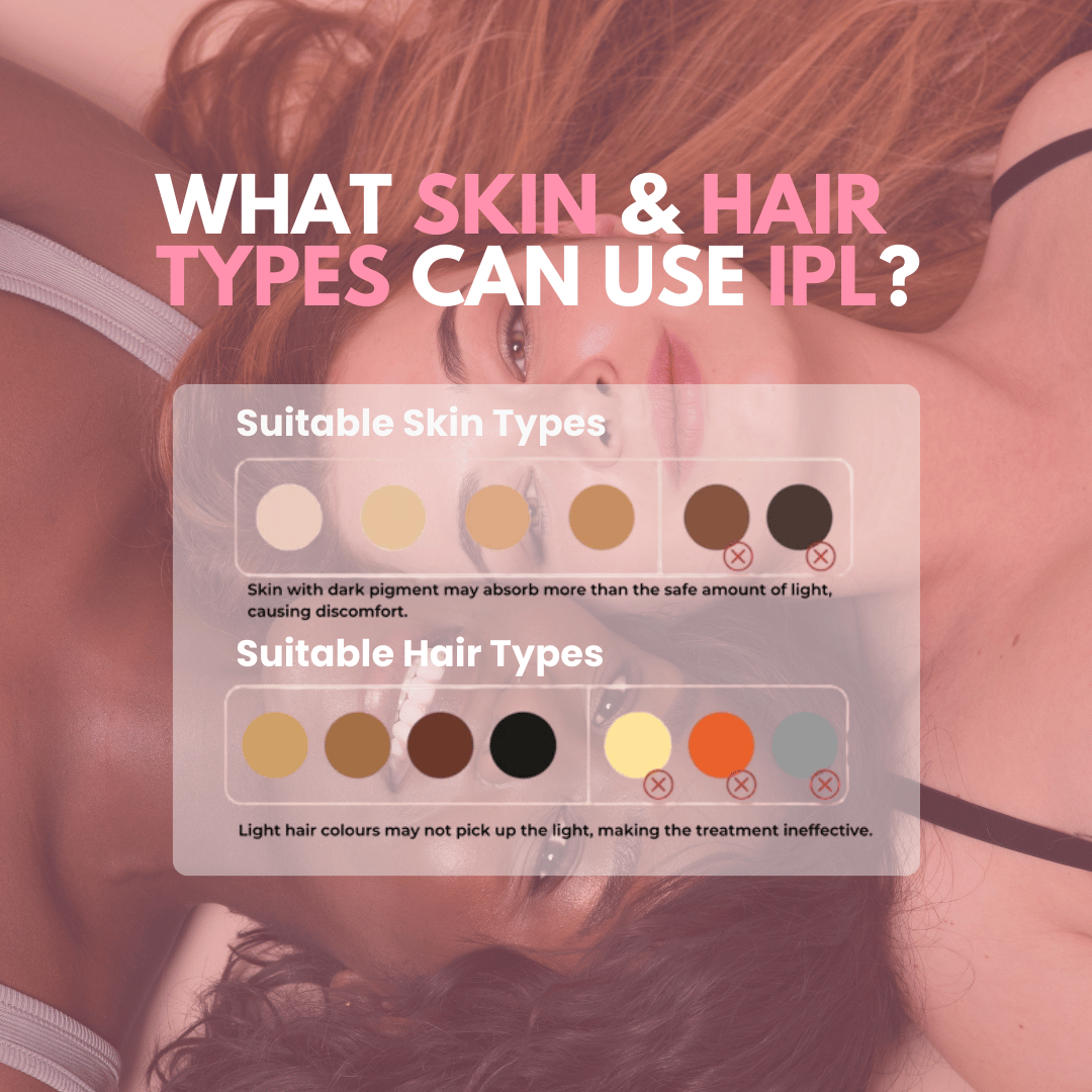 SkinFusion™ IPL Hair Handset